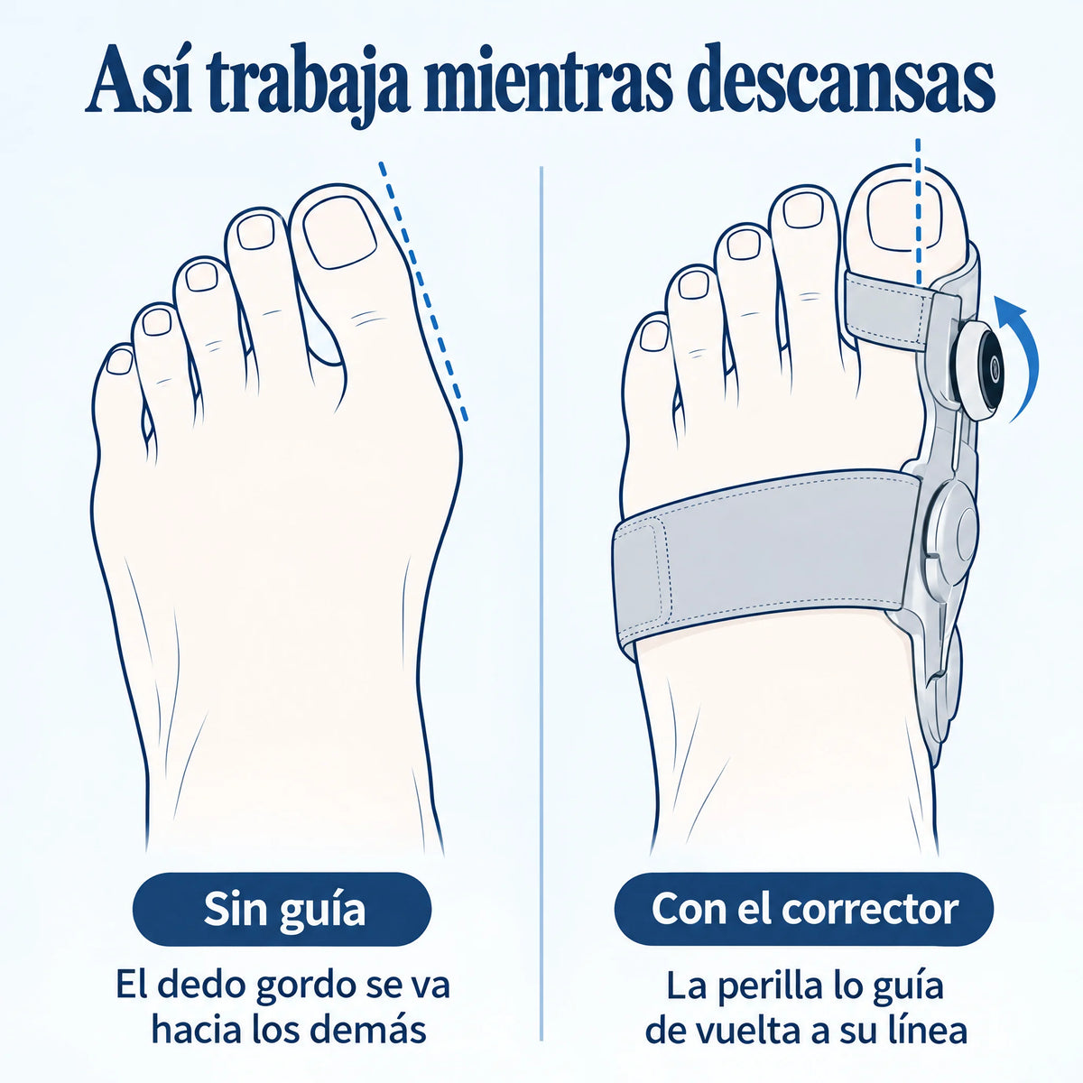 Corrector de Juanete con Perilla Ajustable