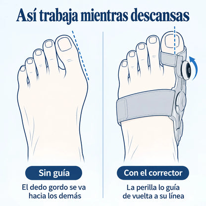 Corrector de Juanete con Perilla Ajustable